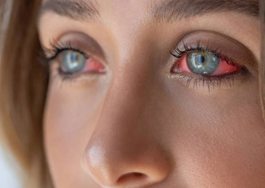Emergency medical eye care consultation at Envision Optometry