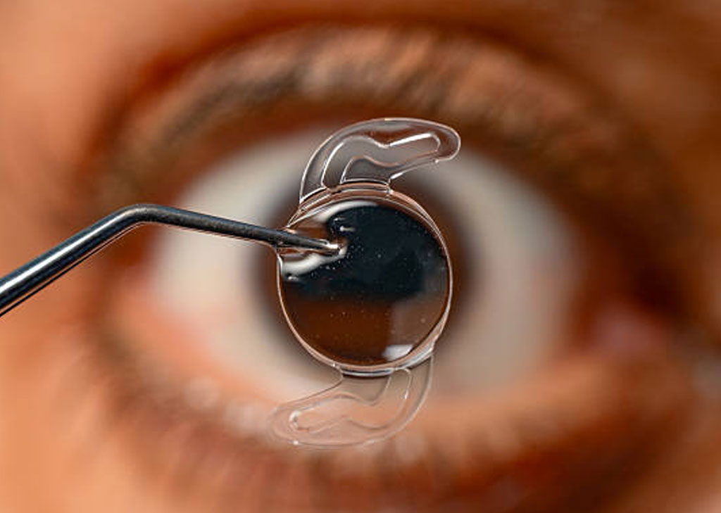 Surgical co-management pre and post-operative eye care