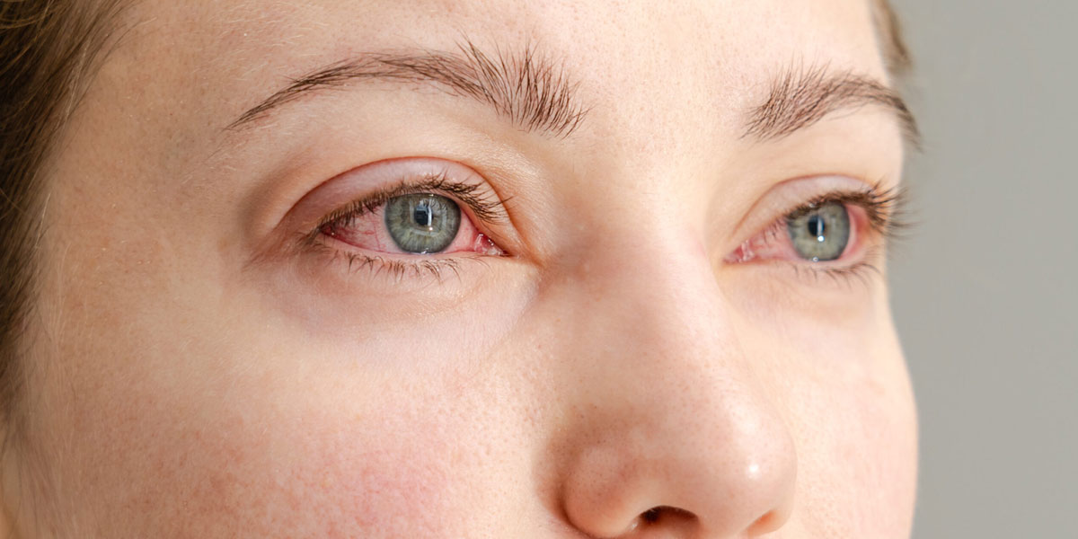 Dry Eye Affect Vision